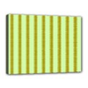 Geared Sound Canvas 16  x 12  (Stretched) View1